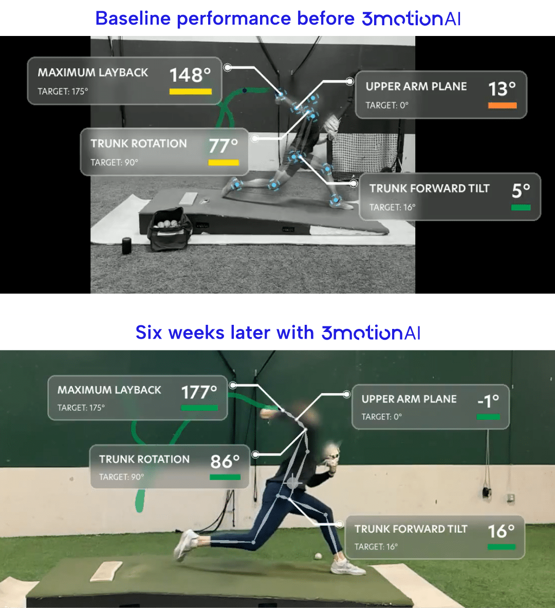 Top softball training equipment with AI